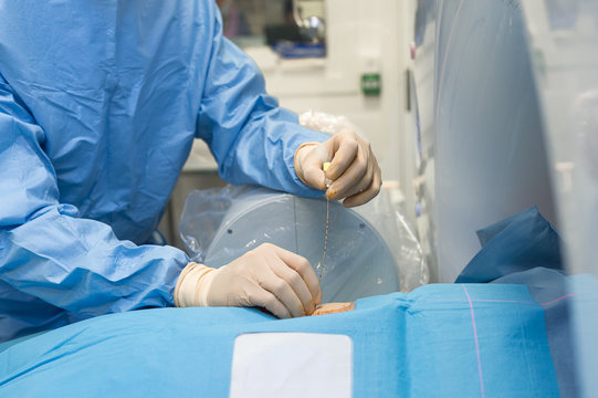 VERTEBROPLASTY