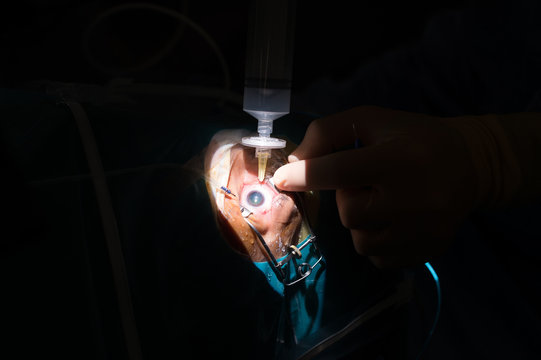 RETINAL DETACHMENT SURGERY