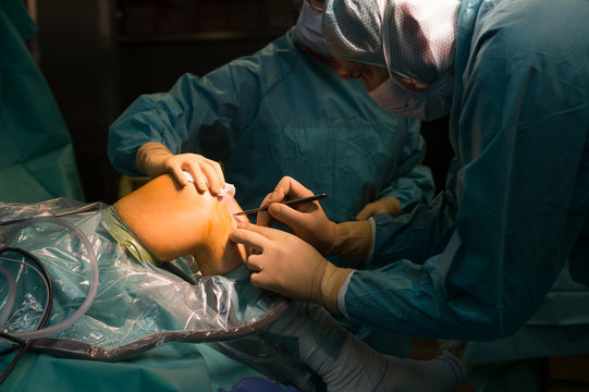 LIGAMENT SURGERY