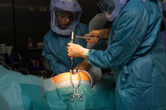 HIP PROSTHESIS SURGERY