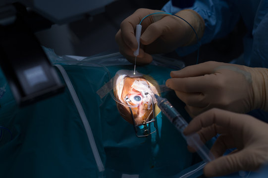 RETINAL DETACHMENT SURGERY