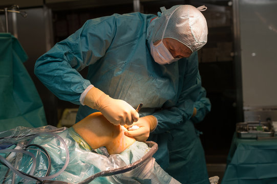 LIGAMENT SURGERY