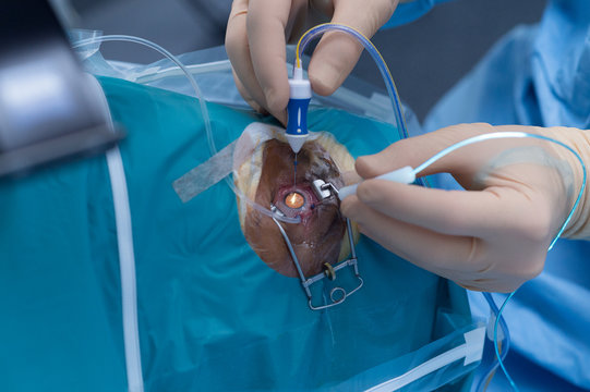 RETINAL DETACHMENT SURGERY