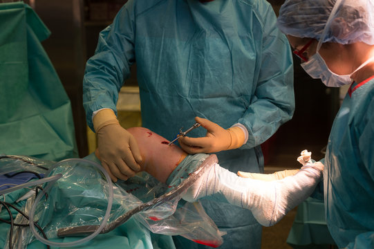 LIGAMENT SURGERY