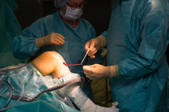 LIGAMENT SURGERY