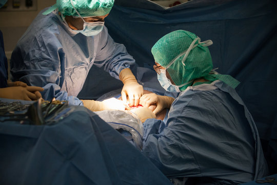 CESAREAN BIRTH