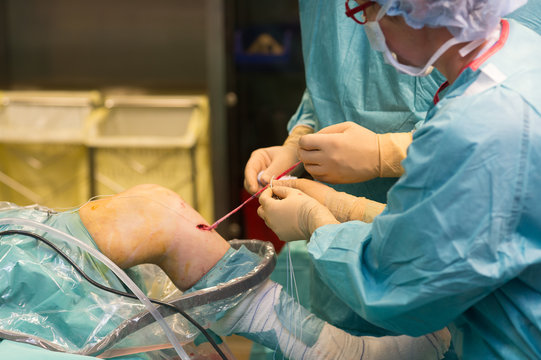 LIGAMENT SURGERY