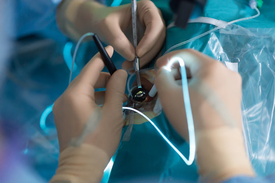 RETINAL DETACHMENT SURGERY