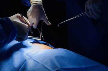 group hands of Doctor and Assistant surgeons work for rescue patient in operation room at hospital,...