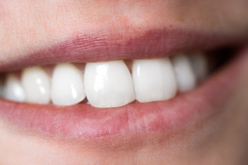 Strahlend weiße gesunde Zähne und rote Lippen, Lächeln