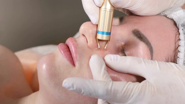Beauty clinic. machine cosmetology concept. Beautician makes facial procedure against vascular spider with laser . Female patient getting cosmetic procedure on face. Shot in 4k