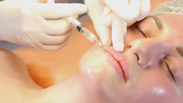 Beauty clinic concept. Close-up of beautician hands making botox injection to female lips and nose. Young woman gets facial injection procedur.. Facial rejuvenation. 4k