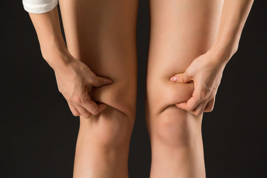 膝上の脂肪をつまむ女性