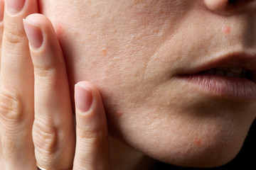 Face skin of young lady between 30 and 35 years old. Closeup