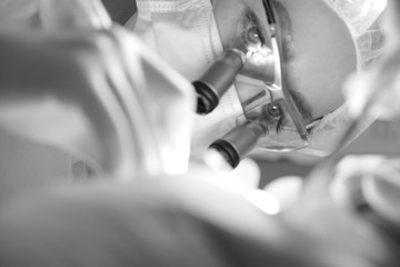 Female dentist in surgical uniform at the clinic while performing surgery for the patient
