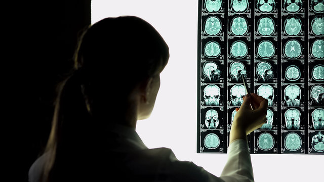 Neurosurgeon looking at patient brain x-ray, pointing image, hospital internship