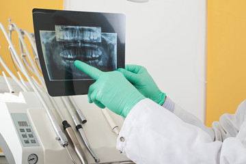 Dentist examining panoramic radiography
