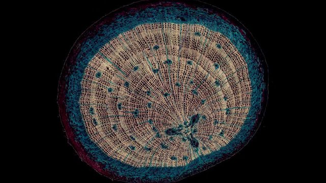 Pinus, pine, older woody root - microscopic cross section cut of a plant stem - dark field
