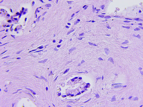 Human tissue microscopic photography
