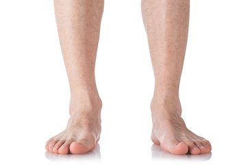 Male foot, heel, feet. Muscle