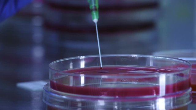 HIV test - blood analysis. Blood sample being analyzed in order to detect a virus