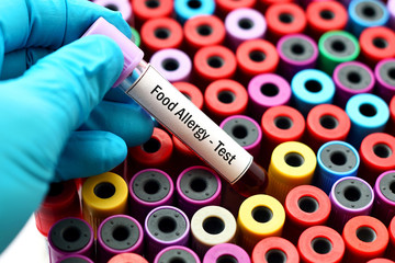 Obraz premium Blood for food allergy test 