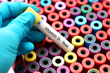 Obraz premium Blood sample for vitamin D test
