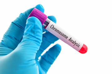 Obraz premium Blood sample for chromosome test 