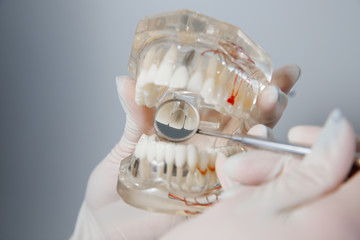Fototapeta na wymiar Jaw breadboard. Orthodontist holds jaw in his hands for training. Package with capillaries, roots, pins.