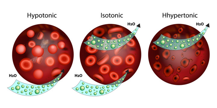 
Effect of different solutions on blood cells.The effect of osmosis on cells. Hypotonic, Isotonic, and Hypertonic solution. Tonicity