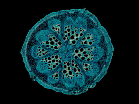 Bryonia, Stem With Sieve Plates - Microscopic Cross Section Cut Of A Plant Stem - Dark Field