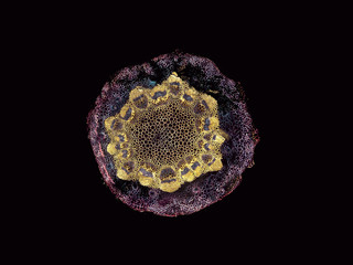 Microscopic cross section of plant stem