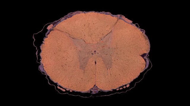 Spinal cord - cross section cut under microscope - dark field