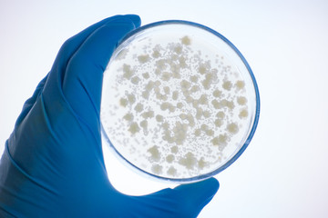 A hand in a glove holds a petri dish. Colonies of bacteria on a petri dish on translucence in white...