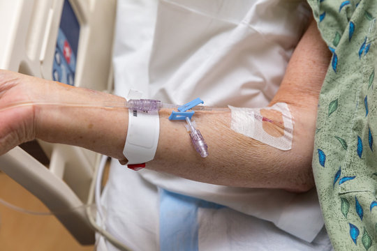 Intravenous Needles in Elderly Patient's Arm