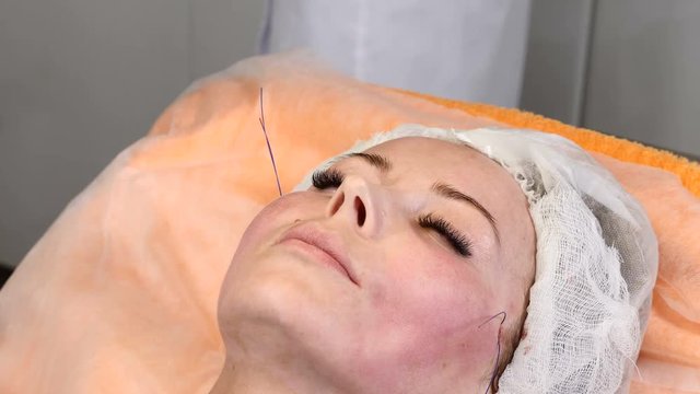 Beauty clinic. Young female client gets thread face lifting. Cosmetologist in gloves making face anti-aging to a female face