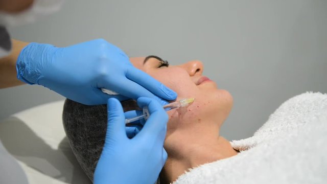 Young woman getting Biorevitalization of the face procedure. Beautician hands in gloves making face aging injection in a female skin. A woman gets beauty facial cosmetology procedure.