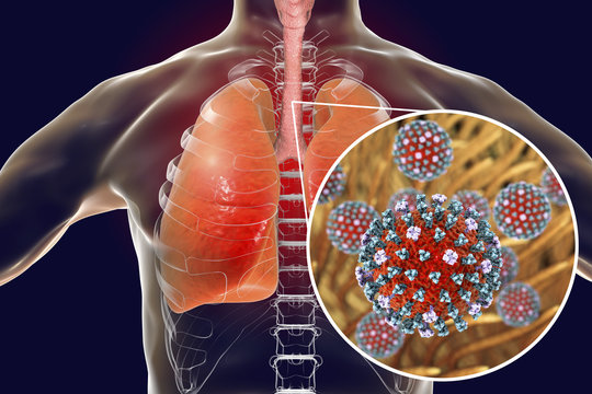 Flu viruses in human lungs, 3D illustration showing anatomy of human respiratory system and close-up view of influenza virus inside lungs