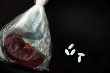 medication cure Diabetic Nephropathy. treatment of diabetes mellitus to slow, avoid renal failure....