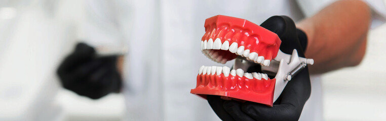 human dental jaw model, concept of dentistry