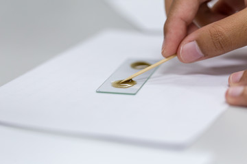 Finding parasites in feces in laboratory. 