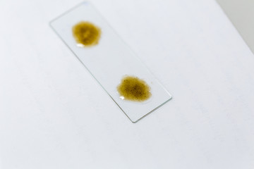 Finding parasites in feces in laboratory. 