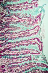 Dünndarm mit Darmzotten unter dem Mikroskop 100x