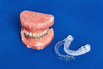 Human jaw or teeth model with metal wired dental braces