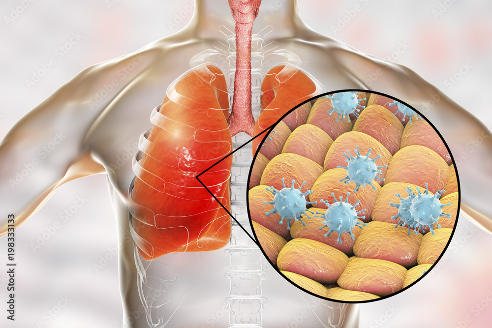 Sticker Viruses in human lungs