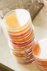 Pile of petri dish with growing cultures of microorganisms on orange and red substrate