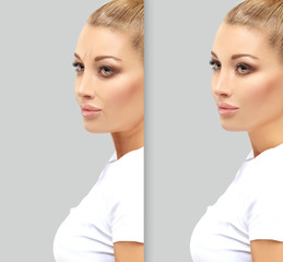 Aging. Mature woman-young woman.Face with skin problem.Before and after cosmetic procedures