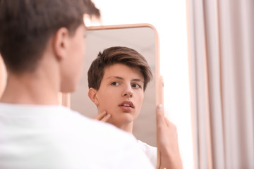 Teenage boy with acne problem looking in mirror at home © New Africa