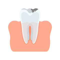 Damaged caries tooth. Flat vector cartoon illustration. Objects isolated on white background.