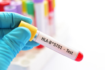 Obraz premium Blood sample for HLA-B*5701 test, diagnosis for hypersensitivity to antiretroviral (ARV) drug abacavir